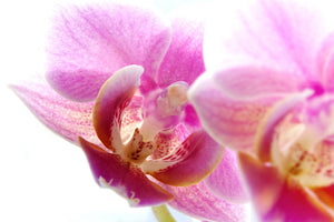 3-piece-aluminium-print-magnificent-phalaenopsis
